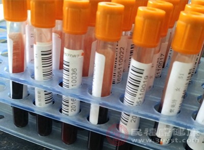 定期体检可以帮助我们及时发现和处理潜在的健康问题
