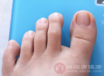 合理外用抗真菌药
