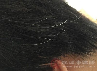 如果饮食中铜的摄入不足，可以考虑使用补充剂