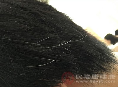 人类的头发会在30岁以后逐渐出现少量白发